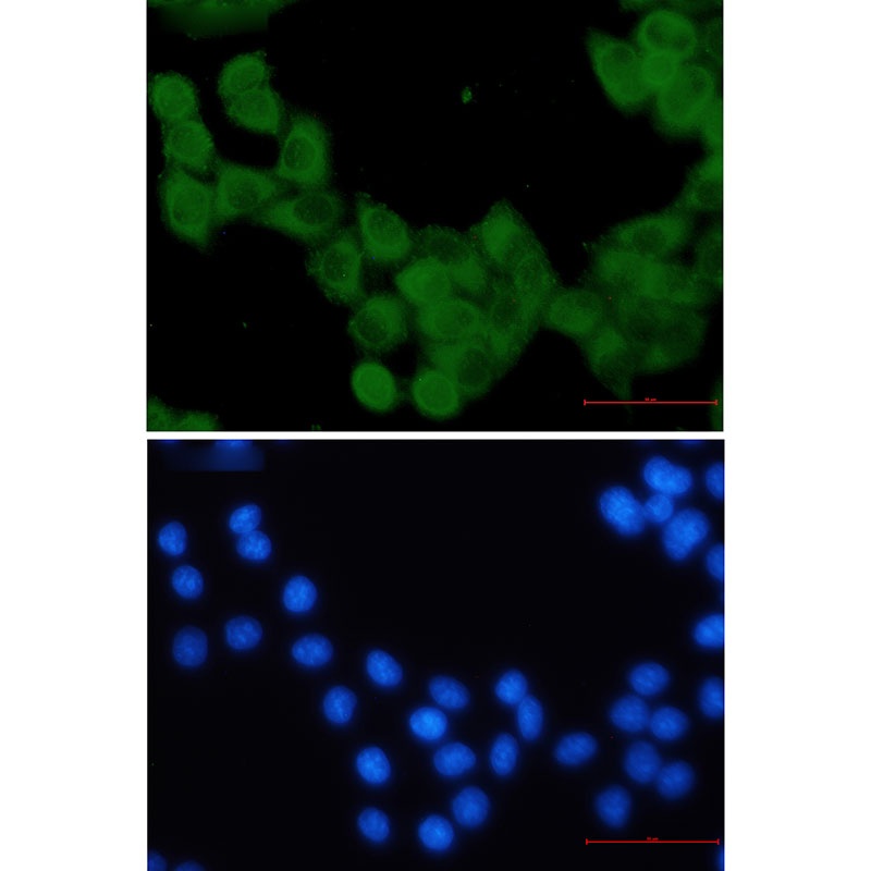 KIF5B Rabbit Monoclonal Antibody