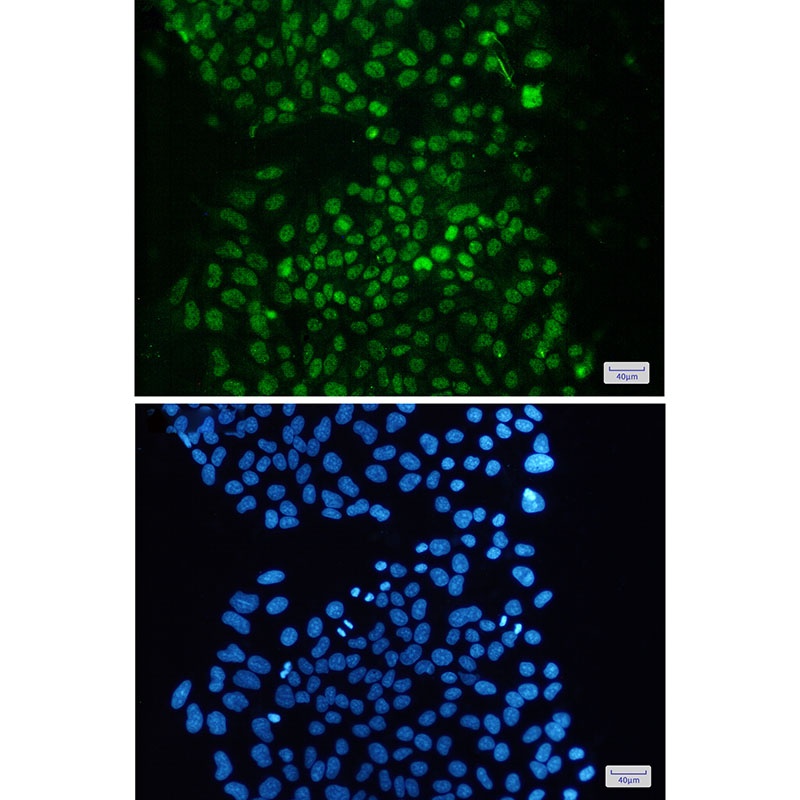 KDM1/LSD1 Rabbit Monoclonal Antibody
