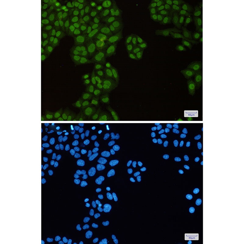 TRIM28 Antibody