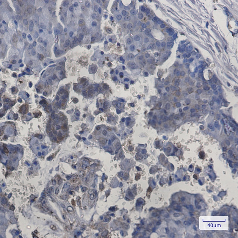 ITPA Antibody