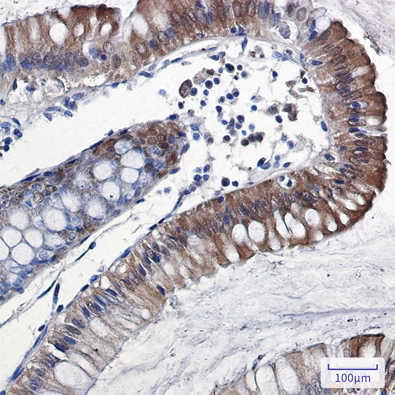 IL-18 Rabbit mAb