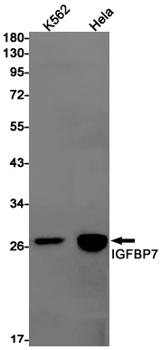 IGFBP7 Antibody