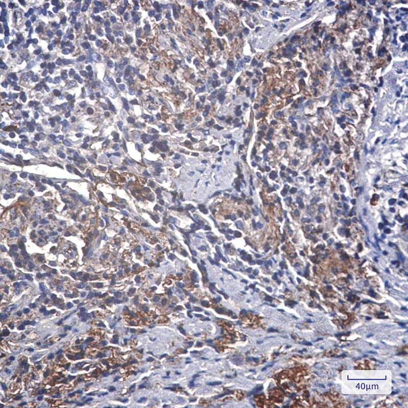 IGFBP7 Antibody