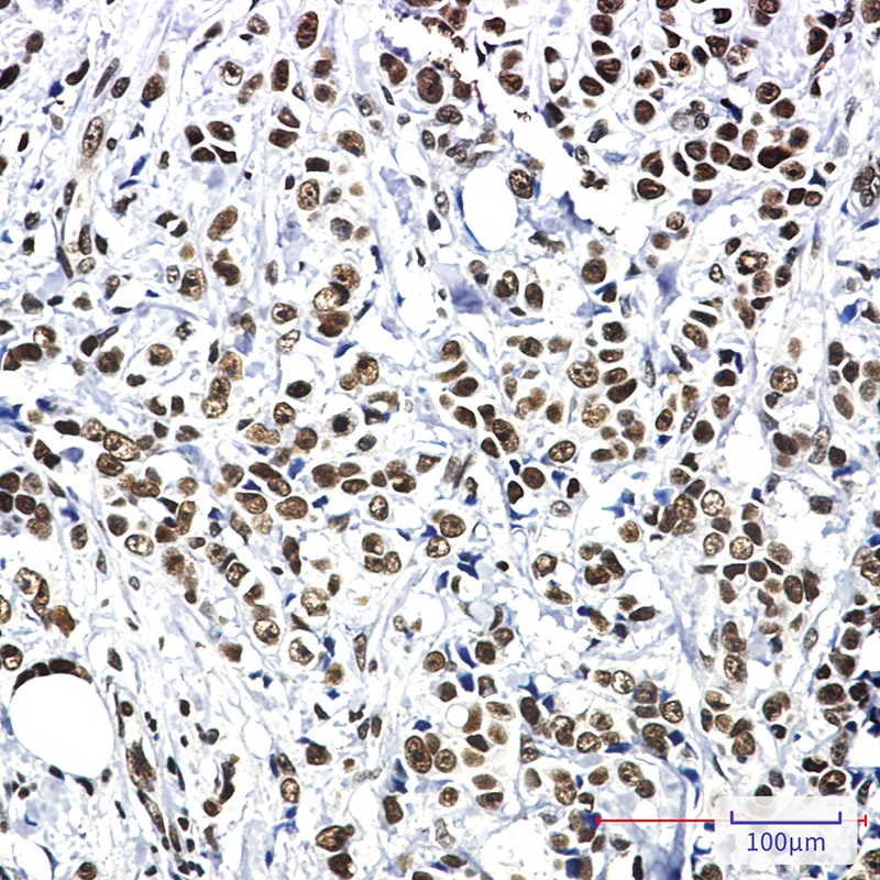 HSF1 Antibody