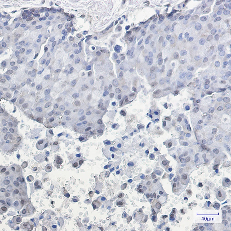 HSF1 Antibody
