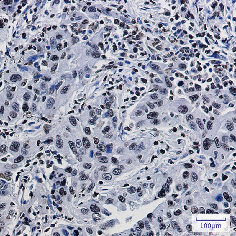H1-3 Antibody