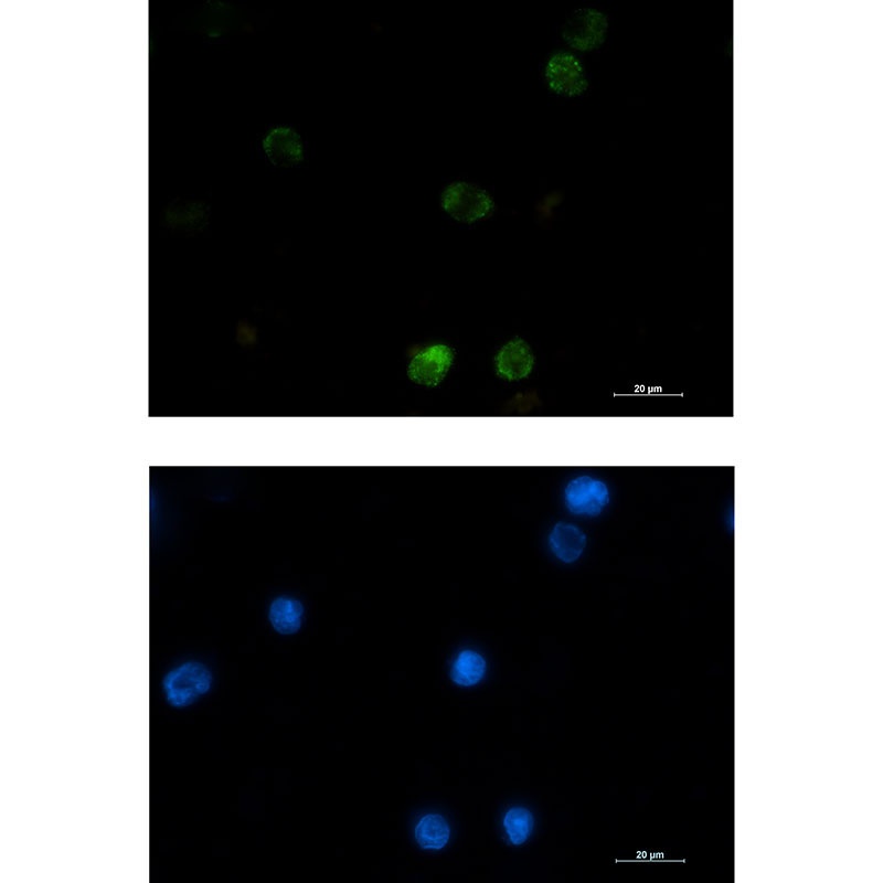 HK1 Antibody