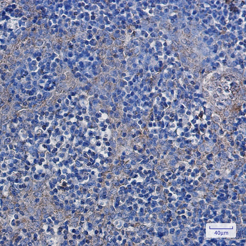 HK1 Antibody