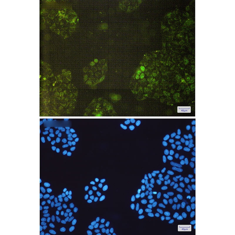GSTK1 Antibody