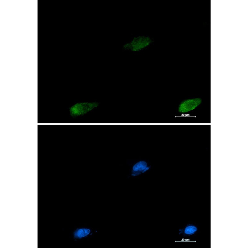 Galectin 3 Rabbit Monoclonal Antibody