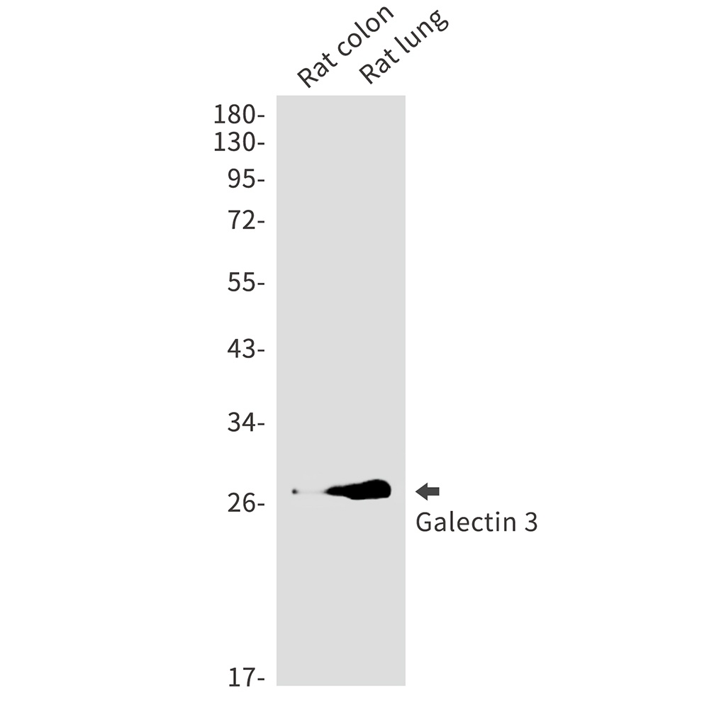 Galectin 3 Rabbit Monoclonal Antibody