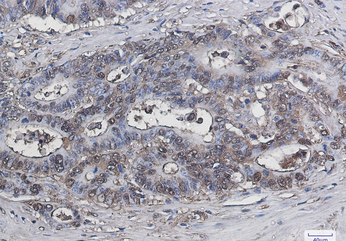 Galectin 3 Rabbit Monoclonal Antibody
