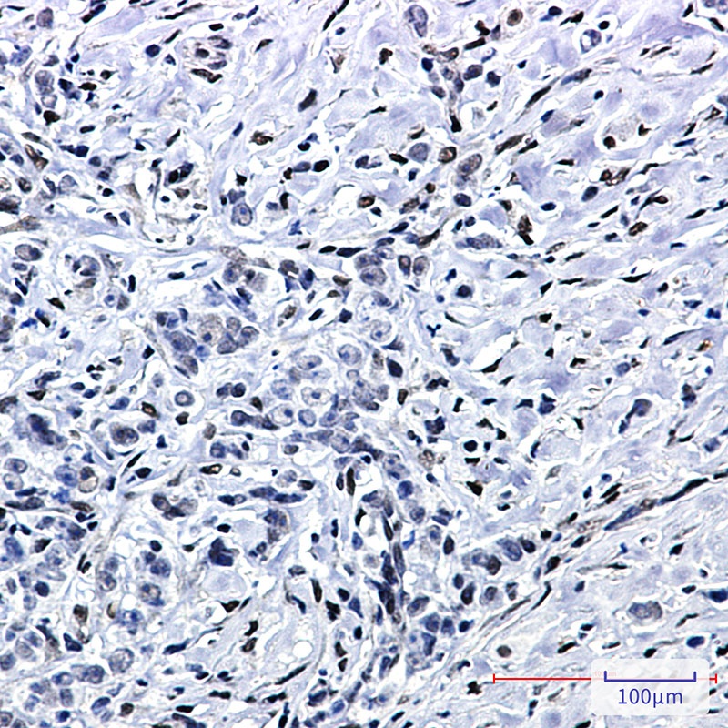 FTO Antibody