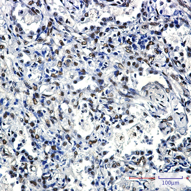 FTO Antibody