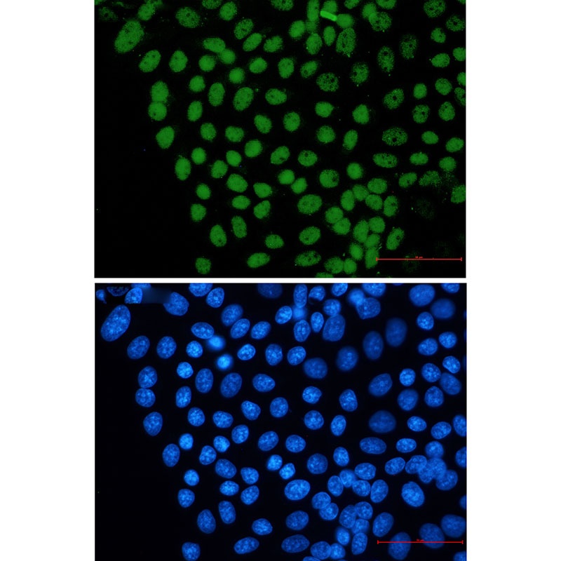 FTO Antibody
