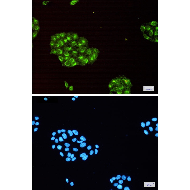IFITM3 Antibody