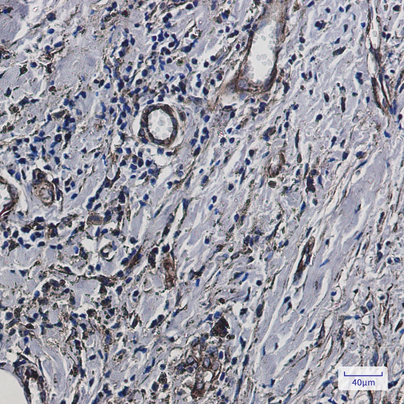 IFITM3 Antibody