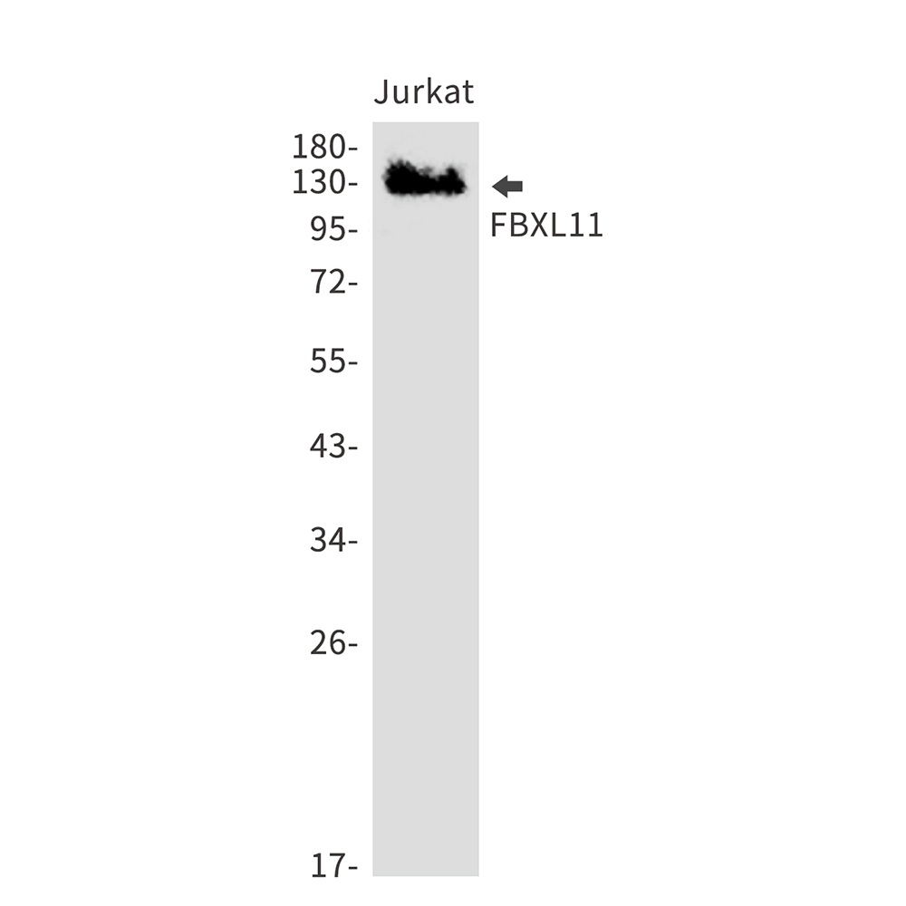 KDM2A Antibody