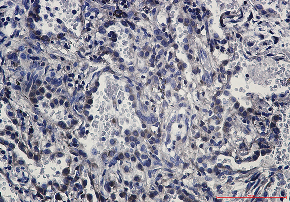 FAS Antibody