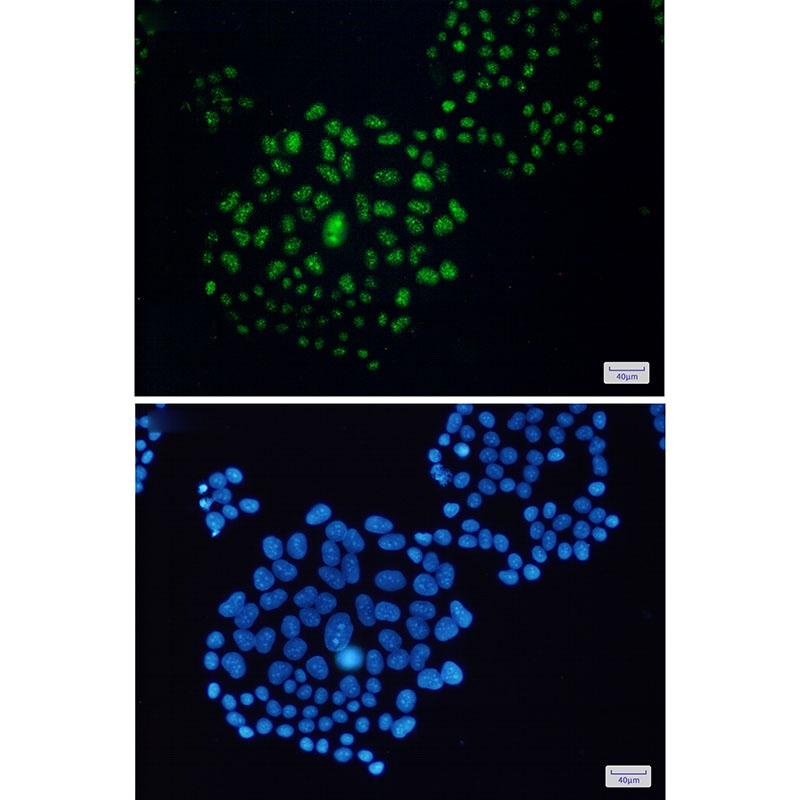 EWSR1 Rabbit Monoclonal Antibody