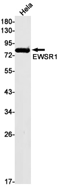 EWSR1 Rabbit Monoclonal Antibody