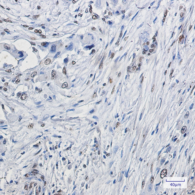 ELK1 Antibody