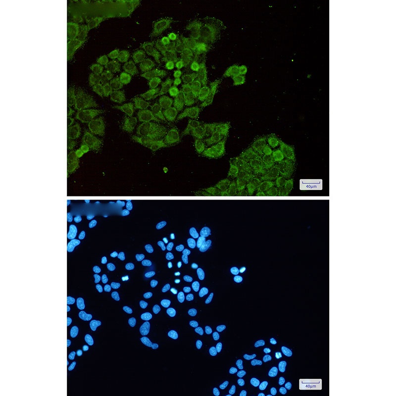 Dnmt1 Rabbit Monoclonal Antibody