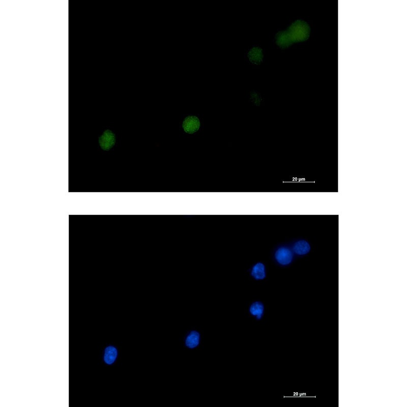 DKC1 Antibody