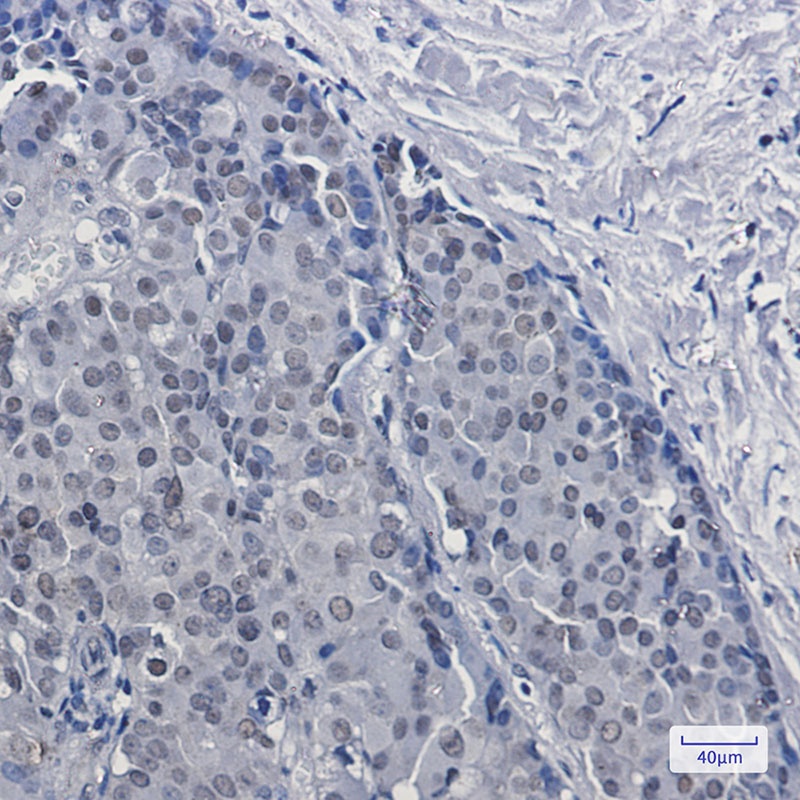 DKC1 Antibody