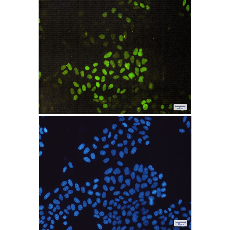 CCNE2 Antibody