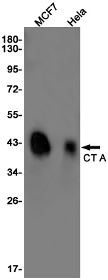 CT A Rabbit Monoclonal Antibody