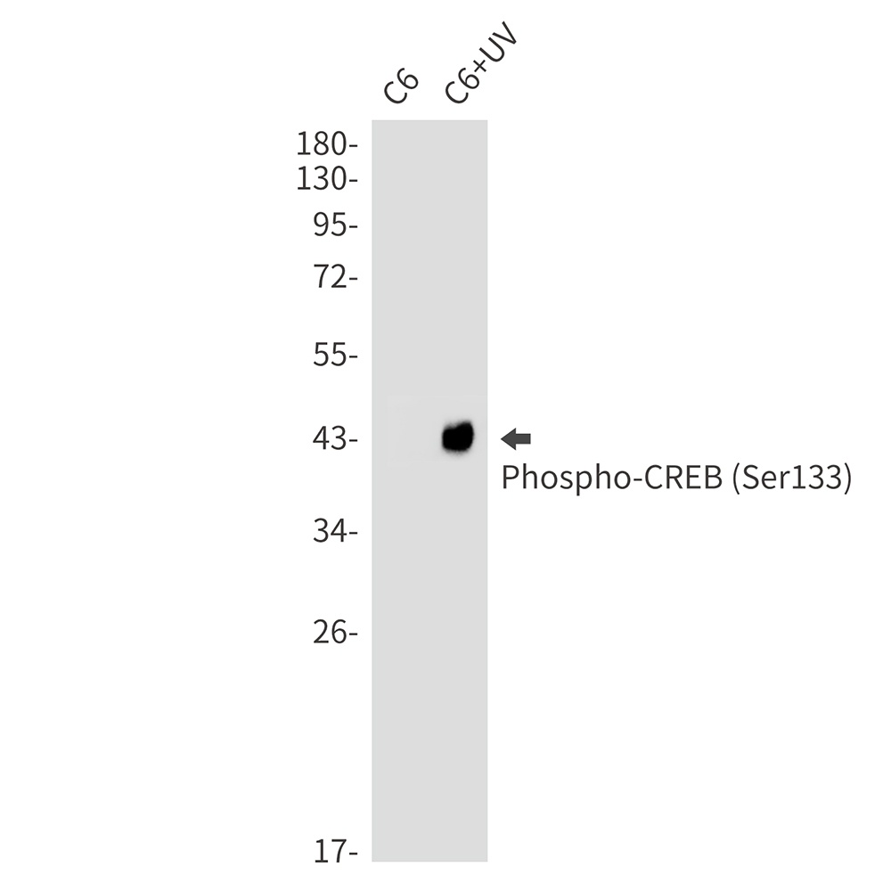 Phospho-CREB (Ser133) Rabbit Monoclonal Antibody