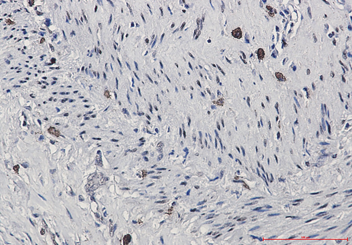 Phospho-CREB (Ser133) Rabbit Monoclonal Antibody