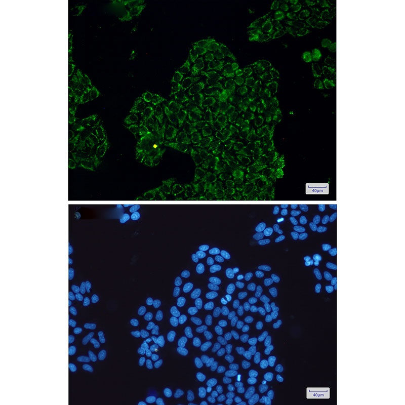 CLIC4 Antibody