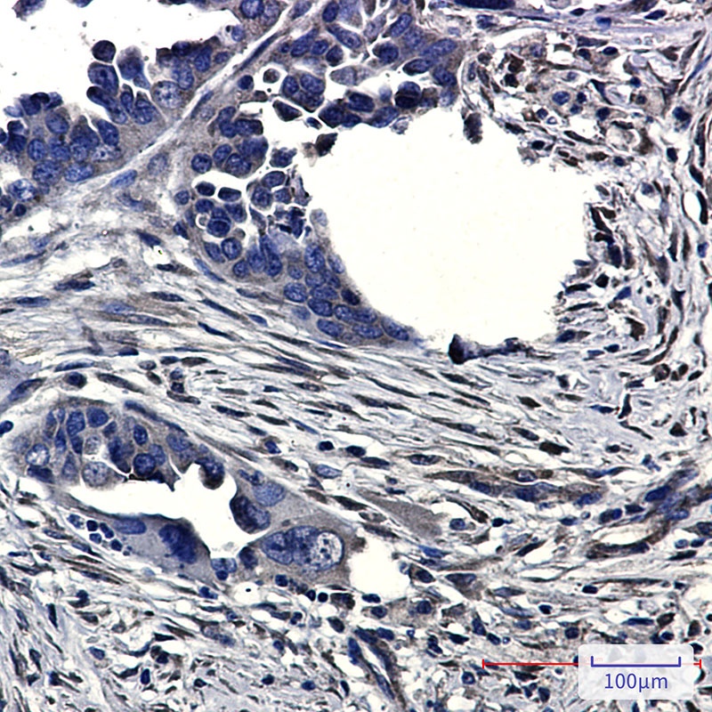 CLIC4 Antibody