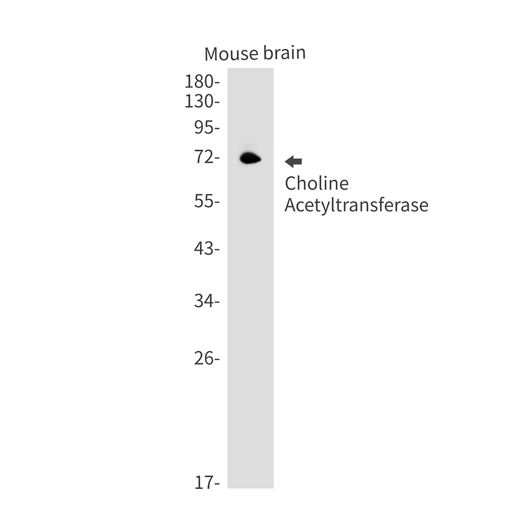 Choline Acetyltransferase Rabbit Monoclonal Antibody