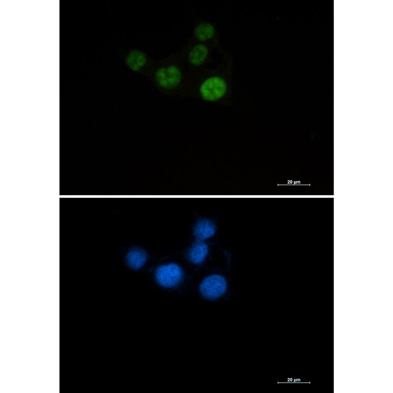 CHEK2 Antibody