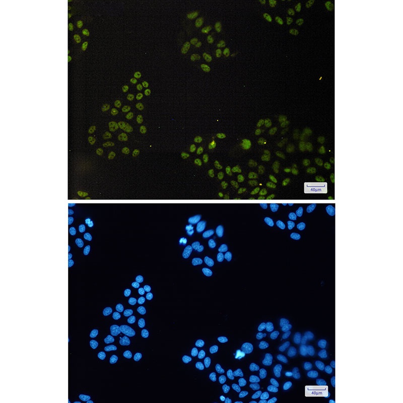 CXXC1 Antibody