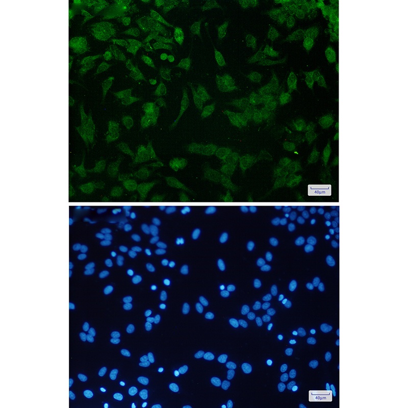 CDKN2A/p16INK4a Rabbit Monoclonal Antibody