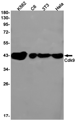 CDK9 Rabbit Monoclonal Antibody