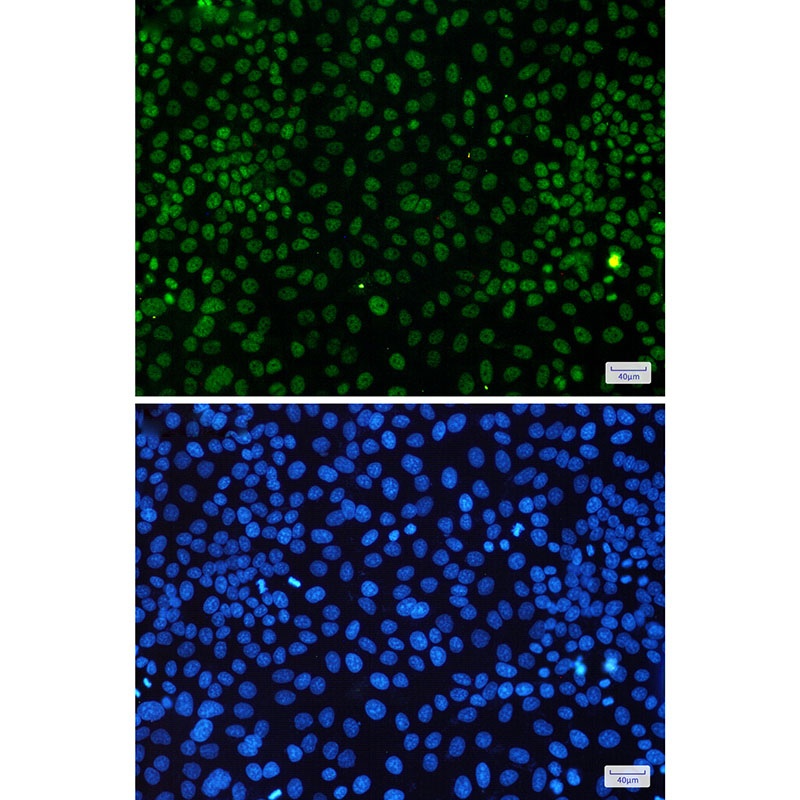 CDK9 Rabbit Monoclonal Antibody