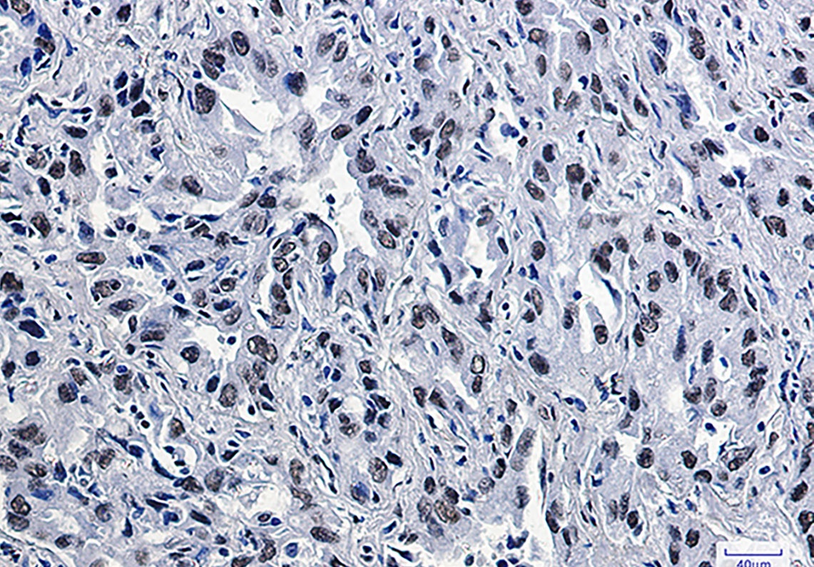 CDK9 Rabbit Monoclonal Antibody