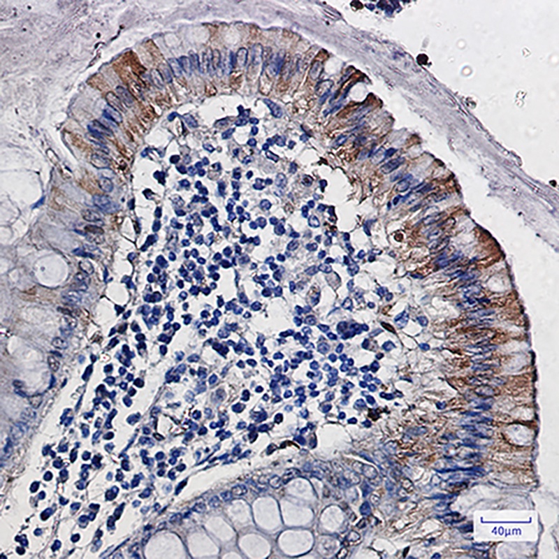 CDA Antibody