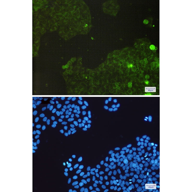 CAT Antibody