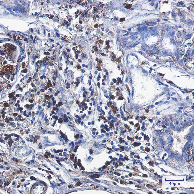 CAT Antibody