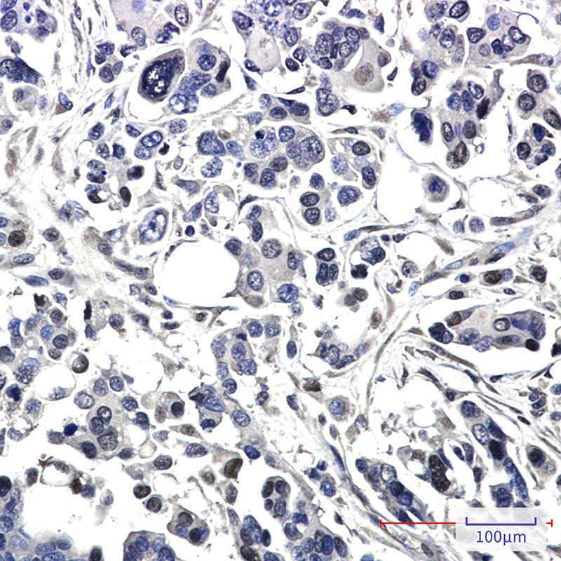 BAG1 Antibody