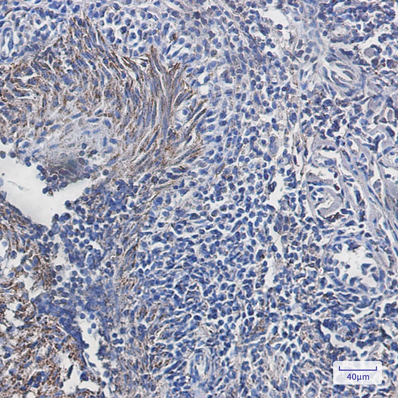 ATP5F1B Antibody