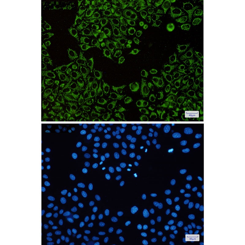 ATP5F1B Antibody