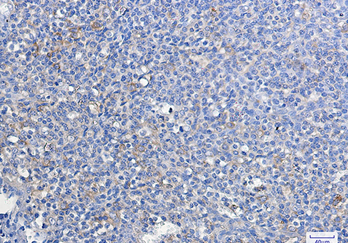 ATG3 Rabbit Monoclonal Antibody