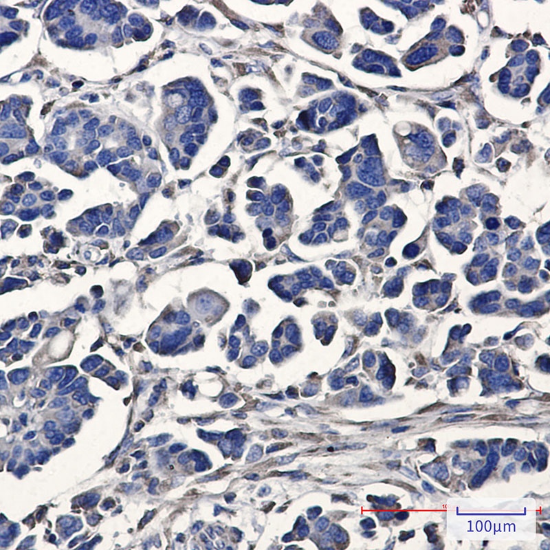 ATE1 Antibody